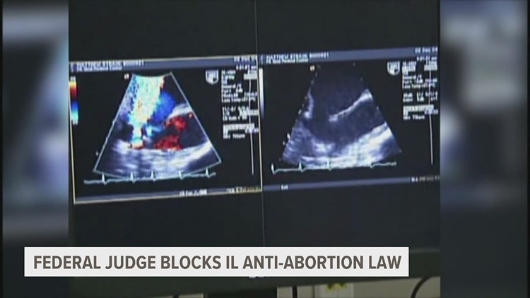 Illinois abortion counseling law blocked by federal judge